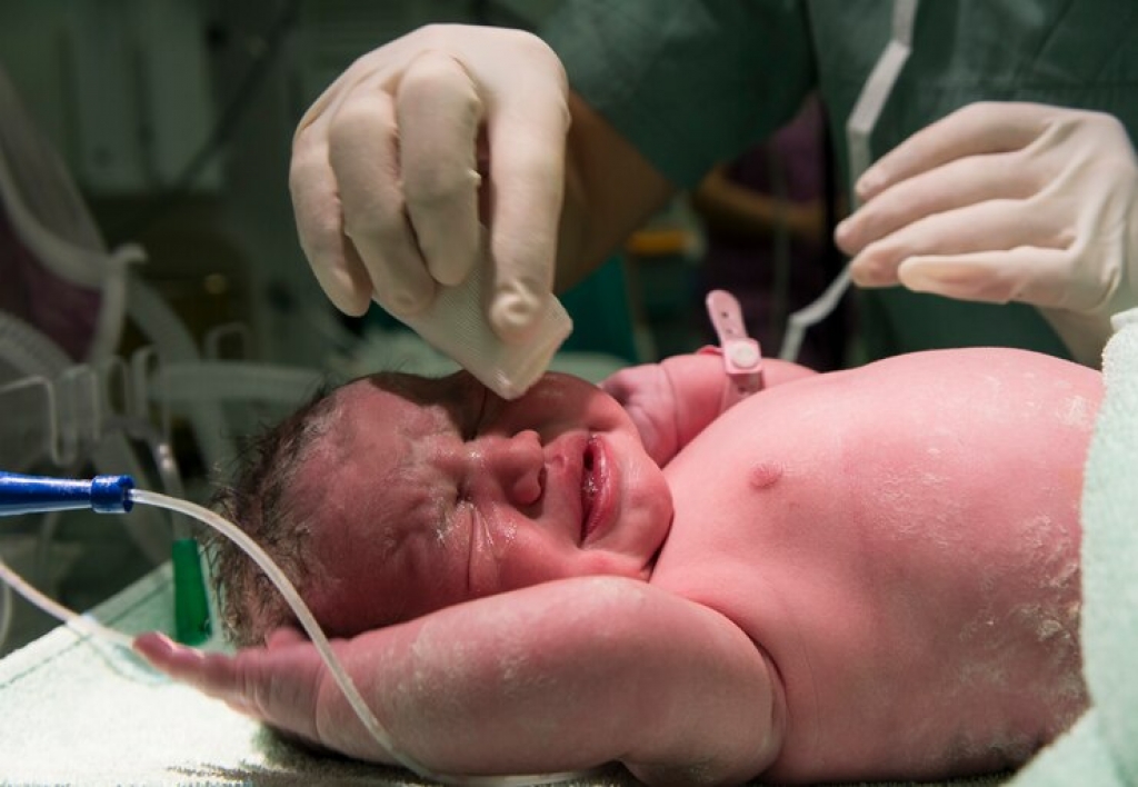 Cuidados Críticos e Intensivos Neonatales