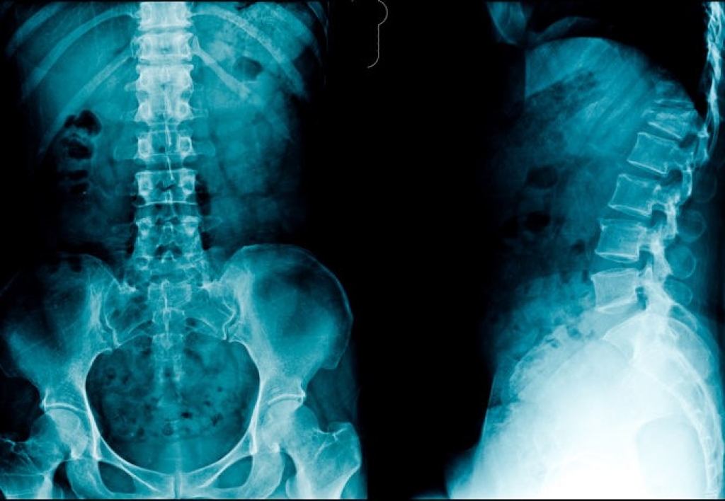 Imagenología Musculoesquelética